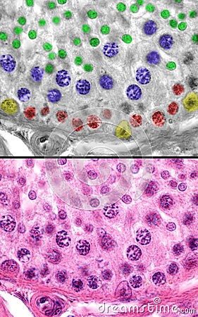 Human testicle. Spermatogenesis Stock Photo