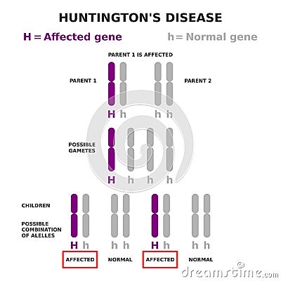 Huntington's disease genetics. Autosomal dominant inheritance. Vector Illustration