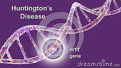 Huntington's disease, a neurodegenerative disease due to mutation in the huntingtin gene, HTT, conceptual 3D Cartoon Illustration