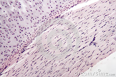 Hyaline cartilage Stock Photo