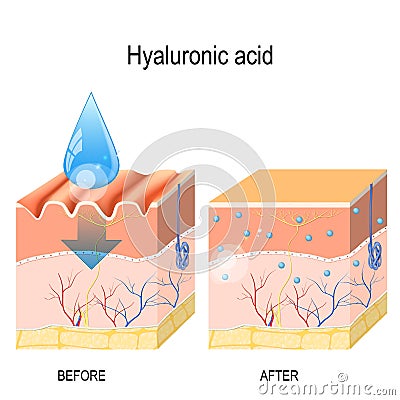 Hyaluronic acid. skin rejuvenation with help of hyaluronic acid Vector Illustration
