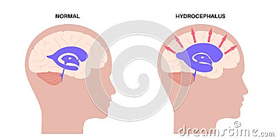 Ventricular system concept Vector Illustration