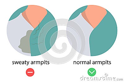 Hyperhidrosis, wet armpits, excessive sweating, sweat, before and after applying deodorant, flat vector illustration Vector Illustration
