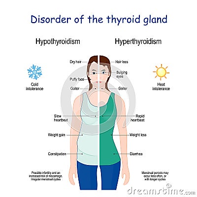 Hyperthyroidism and Hypothyroidism. Female with Signs and symptoms of different thyroid gland diseases Vector Illustration