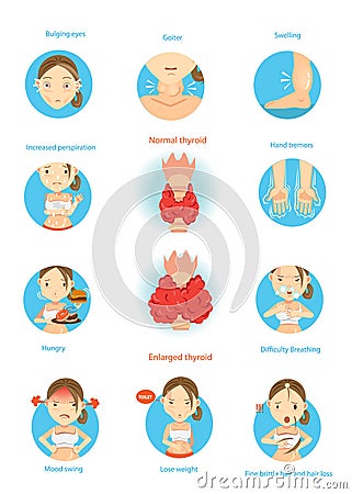 Hyperthyroidism Vector Illustration