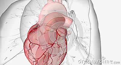 Idiopathic Dilatation of Pulmonary Artery Stock Photo