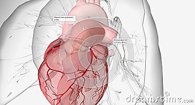 Idiopathic Dilatation of Pulmonary Artery Stock Photo