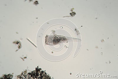 Ð¡iliates infusoria Stentor polymorphic moves by flagella. Protozoa microorganisms Stock Photo