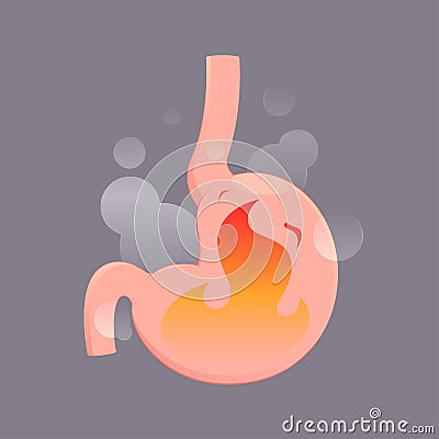 Illustration from acid reflux or heartburn Vector Illustration