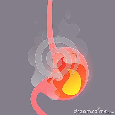 Illustration from acid reflux or heartburn. Vector Illustration