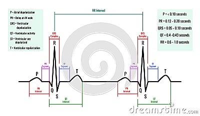 Illustration of ECG interpretation. ECG of a healthy person.Useful for educating doctors and nurses Stock Photo