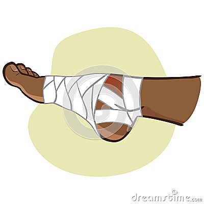 Illustration of first aid person afro descent, bandaged foot, side view Vector Illustration