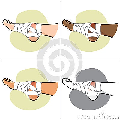 Illustration of first aid person ethnic, bandaged foot, side view Vector Illustration