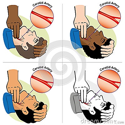 Illustration of First Aid person measuring the pulse Carotid artery, ethnicity Vector Illustration