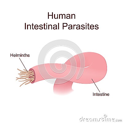 Illustration of internal human parasites Vector Illustration