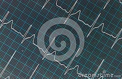 Illustration of the lines showing heartbeat on a heart monitor Cartoon Illustration