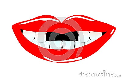 Smiling mouth with tooth gaps Stock Photo