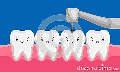 Illustration of tooth drilled by dental drill. Vector Illustration