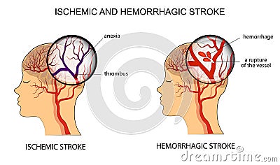 Illustration of the vessels of the brain Vector Illustration