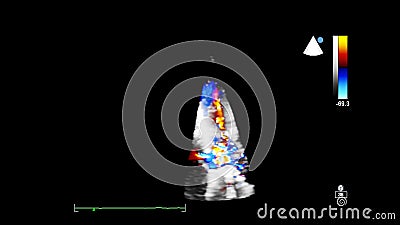 Image of the heart during transesophageal ultrasound. Stock Photo