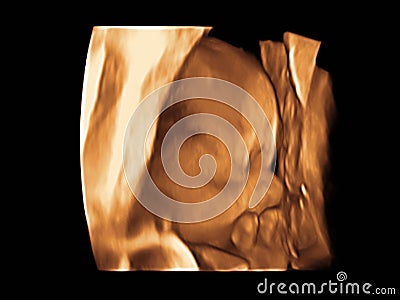 Image Ultrasound 3D, 4D of baby in mother womb Stock Photo