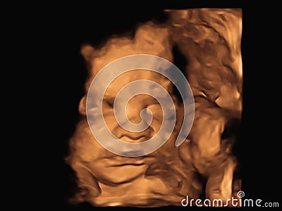 Image Ultrasound 3D4D of baby in mother`s womb Stock Photo