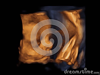 Image Ultrasound 3D, 4D of baby in mother womb Stock Photo