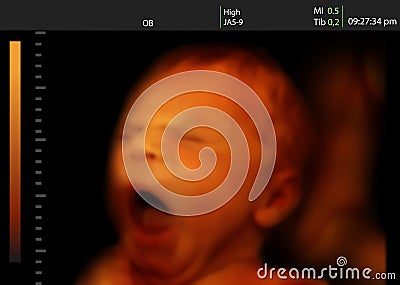Image of a yawning newborn baby like 3D ultrasound Stock Photo