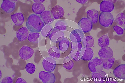 Immature and mature white blood cells Stock Photo