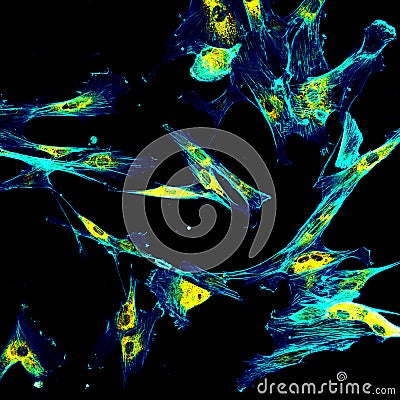 Immunofluorescence confocal imaging of fibroblasts Stock Photo