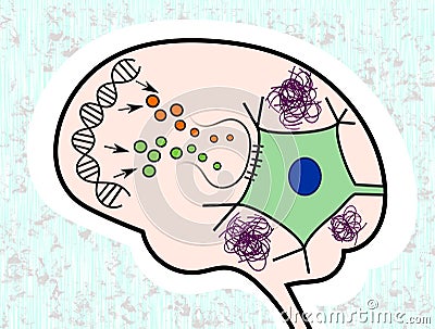 Impaired signalling in Alzheimer's Disease Stock Photo