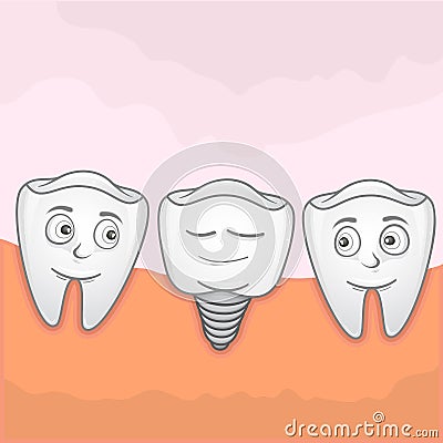 Implantation Tooth Cartoon Illustration