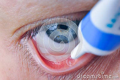 Instill eyedrops or ointment on eye Stock Photo