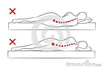 The incorrect spine alignment when sleeping. Vector Illustration