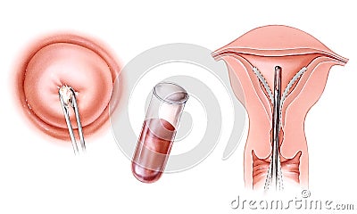 Infertility Tests Stock Photo