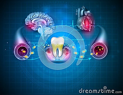 Inflamed gums Vector Illustration