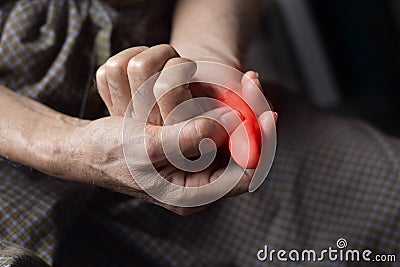 Inflammation of Asian man thumb. Concept of painful digit, cellulitis or finger problems Stock Photo