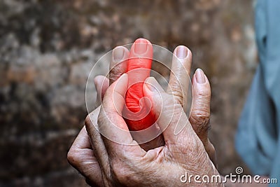 Inflammation of Asian man middle finger and hand. Concept of cellulitis and finger problems Stock Photo