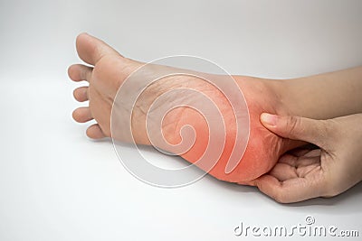 Inflammation at heel. Concept of foot pain Stock Photo