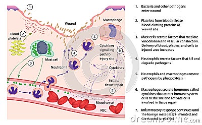 Inflammation and tissue repair Vector Illustration