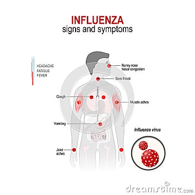 Influenza. Signs and symptoms Vector Illustration