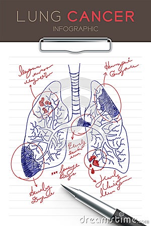 Infographic Lung Cancer set, Doctor writing and hand drawing paper chart with pad Vector Illustration