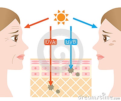 Infographic illustration of difference between UVA and UVB rays. UV penetration into human skin and woman face. skin care and beau Vector Illustration