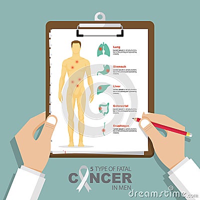 Infographic for top 5 type of fatal cancer in men in flat design. Clipboard in doctor hand. Medical and health care report. Vector Illustration