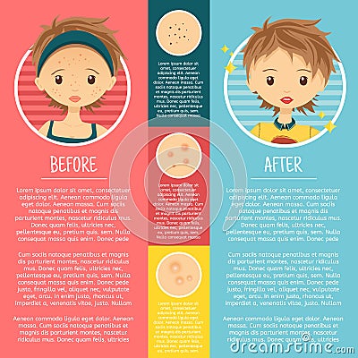 Infographics on problem skin with illustrations Vector Illustration