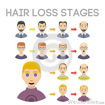 Information chart of hair loss stages types of baldness illustrated on male head vector. Vector Illustration