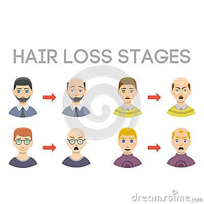 Information chart of hair loss stages types of baldness illustrated on male head vector. Vector Illustration