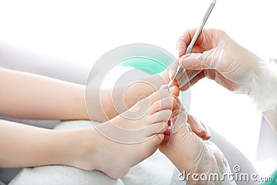 Ingrown toenail. The surgeon cuts his toenail Stock Photo