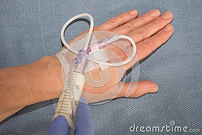 Injection of Propofol through intravenous line in hand Stock Photo