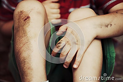 Injured knees Stock Photo